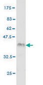 Monoclonal Anti-IRAK2 antibody produced in mouse clone 4C11, purified immunoglobulin, buffered aqueous solution