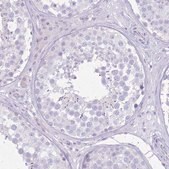 Anti-SLC4A4 antibody produced in rabbit Prestige Antibodies&#174; Powered by Atlas Antibodies, affinity isolated antibody, buffered aqueous glycerol solution