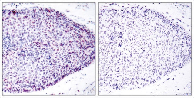 Anti-ATF2 (Ab-62 or 44) antibody produced in rabbit affinity isolated antibody