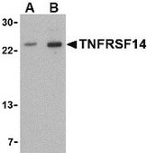 Anti-TNFRSF14 antibody produced in rabbit affinity isolated antibody