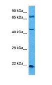 Anti-USP12 antibody produced in rabbit affinity isolated antibody