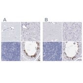 Anti-ACRV1 antibody produced in rabbit Prestige Antibodies® Powered by Atlas Antibodies, affinity isolated antibody, buffered aqueous glycerol solution
