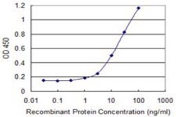 Monoclonal Anti-ARHGAP6 antibody produced in mouse clone 1G5, purified immunoglobulin, buffered aqueous solution