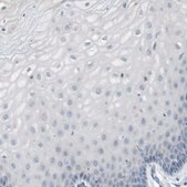 Anti-MOGAT3 antibody produced in rabbit Prestige Antibodies&#174; Powered by Atlas Antibodies, affinity isolated antibody, buffered aqueous glycerol solution