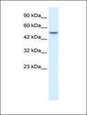 Anti-ANKRD11 antibody produced in rabbit IgG fraction of antiserum