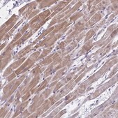 Anti-ST6GALNAC3 antibody produced in rabbit Prestige Antibodies&#174; Powered by Atlas Antibodies, affinity isolated antibody, buffered aqueous glycerol solution