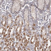 Anti-FMO2 antibody produced in rabbit Prestige Antibodies® Powered by Atlas Antibodies, affinity isolated antibody, buffered aqueous glycerol solution