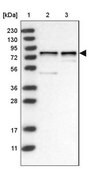 Anti-DCAF8 antibody produced in rabbit Prestige Antibodies® Powered by Atlas Antibodies, affinity isolated antibody, buffered aqueous glycerol solution