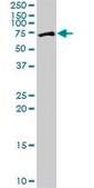 Anti-ZNF133 antibody produced in mouse purified immunoglobulin, buffered aqueous solution