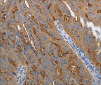 抗-SLC34A2 兔抗 affinity isolated antibody