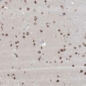 Anti-FNDC1 antibody produced in rabbit Prestige Antibodies® Powered by Atlas Antibodies, affinity isolated antibody, buffered aqueous glycerol solution