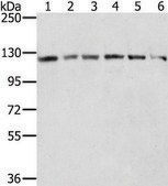 Anti-RNF20 affinity isolated antibody