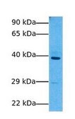 Anti-COQ2 antibody produced in rabbit affinity isolated antibody