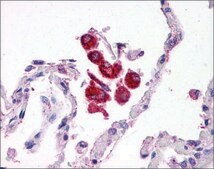 Anti-TLR2 affinity isolated antibody