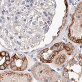 Anti-MRPL18 antibody produced in rabbit Prestige Antibodies&#174; Powered by Atlas Antibodies, affinity isolated antibody, buffered aqueous glycerol solution, ab2