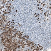 Anti-PLCXD1 antibody produced in rabbit Prestige Antibodies&#174; Powered by Atlas Antibodies, affinity isolated antibody, buffered aqueous glycerol solution