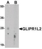 Anti-GLIPR1L2 antibody produced in rabbit affinity isolated antibody