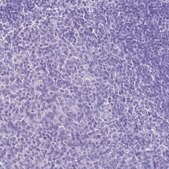 Anti-HSPB6 antibody produced in rabbit Prestige Antibodies&#174; Powered by Atlas Antibodies, affinity isolated antibody, buffered aqueous glycerol solution