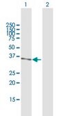 Anti-PRMT6 antibody produced in mouse purified immunoglobulin, buffered aqueous solution