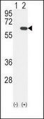 Anti-GCKR (C-term) antibody produced in rabbit IgG fraction of antiserum, buffered aqueous solution