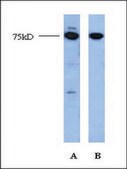 Anti-EGR2 antibody produced in rabbit affinity isolated antibody