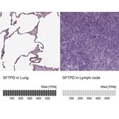 抗SFTPD 兔抗 Prestige Antibodies® Powered by Atlas Antibodies, affinity isolated antibody, buffered aqueous glycerol solution