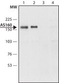 Anti-AS160 antibody produced in rabbit ~1.5 mg/mL, affinity isolated antibody