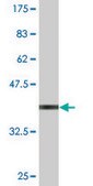 Monoclonal Anti-ZNF306 antibody produced in mouse clone 2A1, purified immunoglobulin, buffered aqueous solution