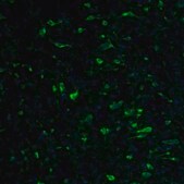 Anti-RPL9 antibody produced in rabbit Prestige Antibodies&#174; Powered by Atlas Antibodies, affinity isolated antibody, buffered aqueous glycerol solution