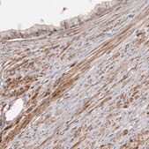 Anti-ADAMTS2 antibody produced in rabbit Prestige Antibodies&#174; Powered by Atlas Antibodies, affinity isolated antibody, buffered aqueous glycerol solution