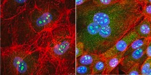 Anti-RRP8 Antibody, clone 5C7.1 clone 5C7.1, from mouse