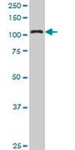 Monoclonal Anti-KIAA1967 antibody produced in mouse clone 4E6, purified immunoglobulin, buffered aqueous solution