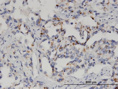 Monoclonal Anti-GSTM2 antibody produced in mouse clone 1E10, purified immunoglobulin, buffered aqueous solution