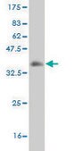Monoclonal Anti-ZNRD1 antibody produced in mouse clone 6C12, purified immunoglobulin, buffered aqueous solution