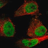 Anti-SSB antibody produced in rabbit Prestige Antibodies&#174; Powered by Atlas Antibodies, affinity isolated antibody, buffered aqueous glycerol solution