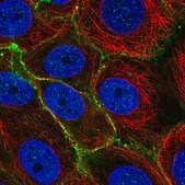 Anti-SLC5A6 antibody produced in rabbit Prestige Antibodies® Powered by Atlas Antibodies, affinity isolated antibody, buffered aqueous glycerol solution