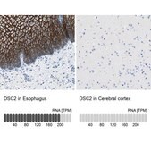 Anti-DSC2 antibody produced in rabbit Prestige Antibodies® Powered by Atlas Antibodies, affinity isolated antibody, buffered aqueous glycerol solution