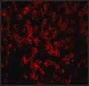 Anti-DRAM (ab1) antibody produced in rabbit affinity isolated antibody, buffered aqueous solution