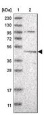 Anti-DEPTOR antibody produced in rabbit Prestige Antibodies® Powered by Atlas Antibodies, affinity isolated antibody, buffered aqueous glycerol solution, Ab2