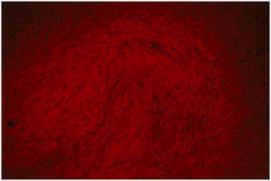 Alizarin-Red Staining Solution Alizarin red is a commonly used stain to identify calcium containing osteocytes in differentiated culture of both human and rodent mesenchymal stem cells (MSCs).