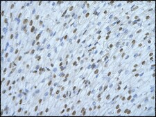 Anti-HNRPDL antibody produced in rabbit IgG fraction of antiserum