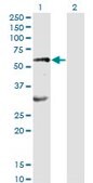 Monoclonal Anti-EPOR antibody produced in mouse clone 3D10, purified immunoglobulin, buffered aqueous solution