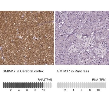 Anti-SMIM17 antibody produced in rabbit Prestige Antibodies&#174; Powered by Atlas Antibodies, affinity isolated antibody