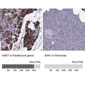Anti-AAK1 antibody produced in rabbit Prestige Antibodies® Powered by Atlas Antibodies, affinity isolated antibody, buffered aqueous glycerol solution