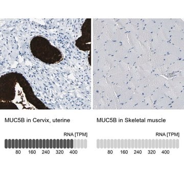 Anti-MUC5B antibody produced in rabbit Prestige Antibodies&#174; Powered by Atlas Antibodies, affinity isolated antibody, buffered aqueous glycerol solution