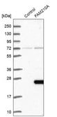 Anti-FAM210A antibody produced in rabbit Prestige Antibodies® Powered by Atlas Antibodies, affinity isolated antibody, buffered aqueous glycerol solution