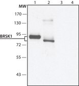 Anti-BRSK1 antibody produced in rabbit ~1.5&#160;mg/mL, affinity isolated antibody