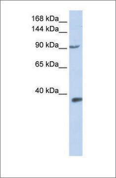 抗-EPAS1 兔抗 affinity isolated antibody