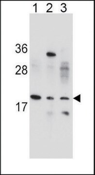 ANTI-VCX1 (N-TERM) antibody produced in rabbit IgG fraction of antiserum, buffered aqueous solution