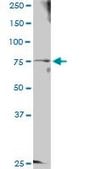 Anti-GTSE1 antibody produced in rabbit purified immunoglobulin, buffered aqueous solution
